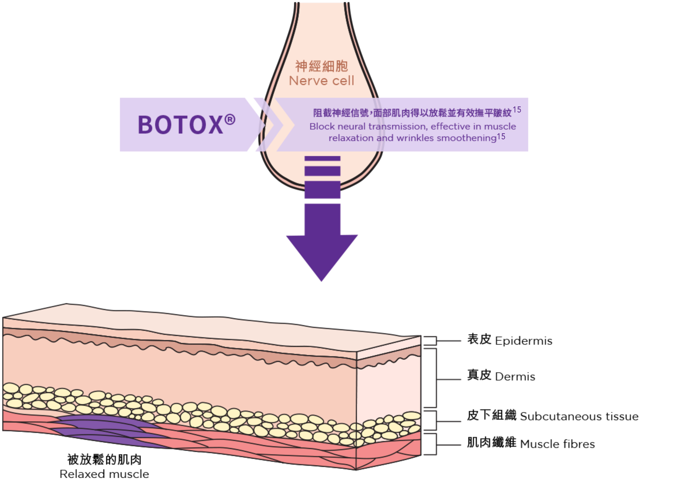 使用 BOTOX® 保妥適後：神經傳導被阻斷，肌肉放鬆