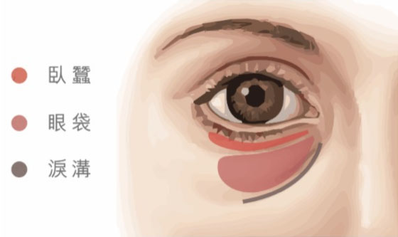 eye-bag 眼周三區解析