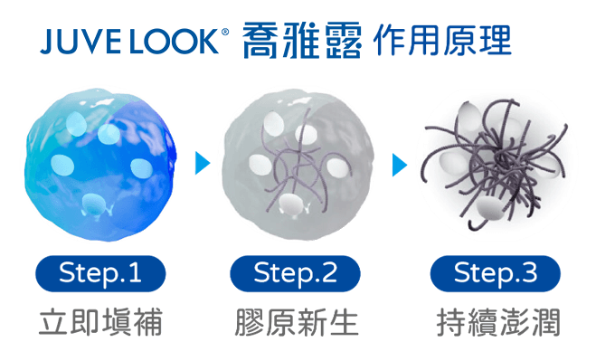 JUVELOOK® 喬雅露 作用原理：立即填補 → 膠原新生 → 持續澎潤
