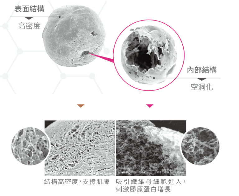 AESTHEFILL® PDLLA 多孔性微球體 — 表面結構與內部空洞化電子顯微鏡影像