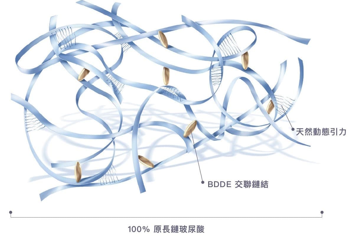 Preserved Network™ 專利技術：100% 原長鏈玻尿酸、BDDE 交聯鏈結、天然動態引力