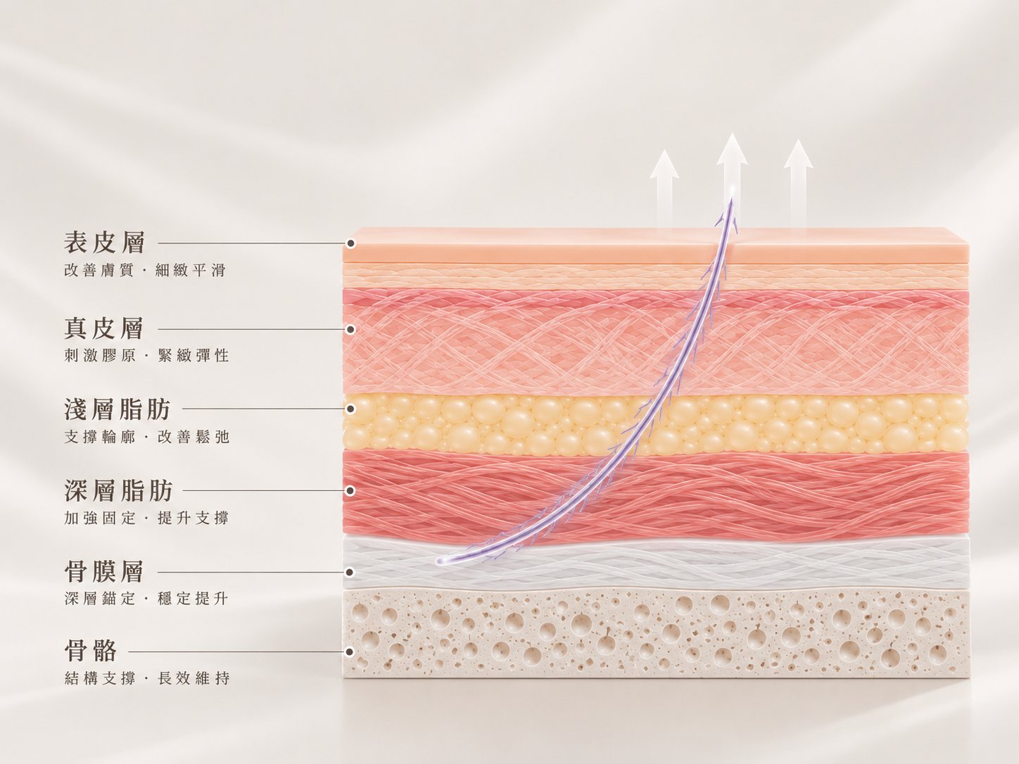thread-lift 皮膚層級示意